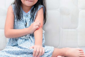 come curare allergia nei bambini